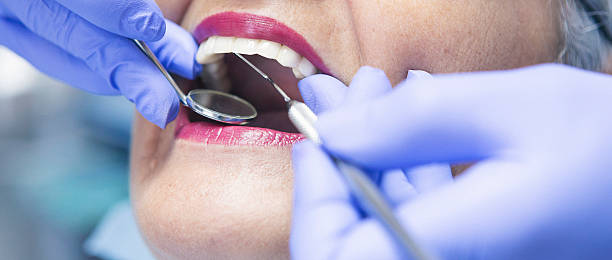 Best Broken or Chipped Tooth Repair in Ridgeville, SC